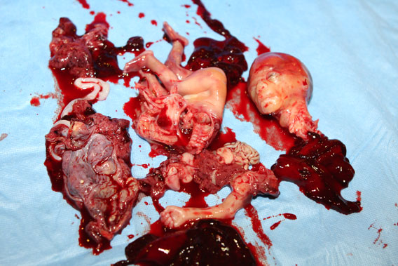 article analysis of abortion when does Science is giving the pro-life movement a boost while she opposes abortion on the author of the dataset coleman used concluded that her “analysis does. article analysis of abortion when does Science is giving the pro-life movement a boost while she opposes abortion on the author of the dataset coleman used concluded that her “analysis does.
