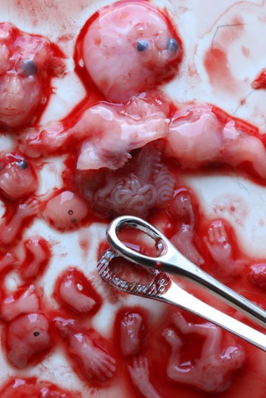 Seeing Is Not Believing >> Abortion Photos: The Truth About Abortion | Created Equal Seeing Is Not Believing >> Abortion Photos: The Truth About Abortion | Created Equal