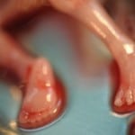 Abortion Photos: Legs and feet of a baby