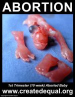 1st Trimester (10 week) Aborted Baby