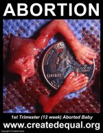 1st Trimester (12 week) Aborted Baby