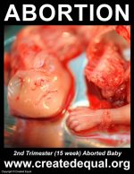 Abortion Sign, 15 week