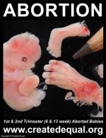 1st Trimester (6 & 13 week) Aborted Babies