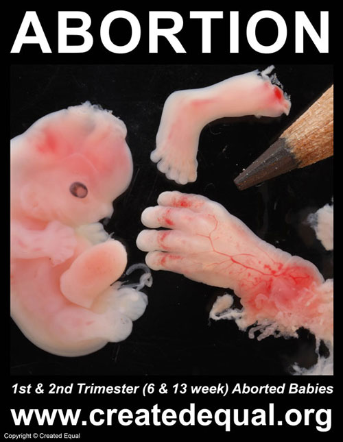 Abortion Signs Exposing The Truth About Abortion