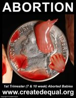 1st Trimester (7 & 10 week) Aborted Babies
