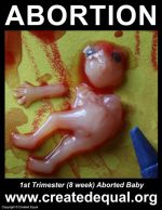 1st Trimester (8 week) Aborted Baby